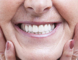 A close up of the teeth of a person smiling